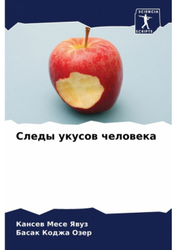 Следы укусов человека