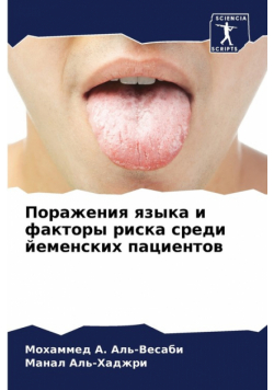 Поражения языка и факторы риска среди йеменских пациентов
