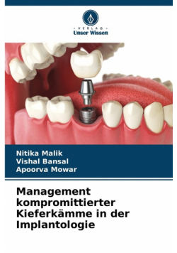 Management kompromittierter Kieferkämme in der Implantologie