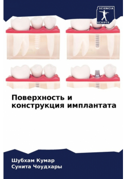 Поверхность и конструкция имплантата