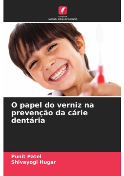 O papel do verniz na prevenção da cárie dentária