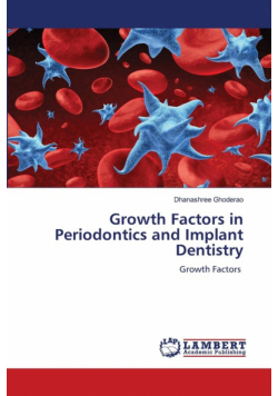 Growth Factors in Periodontics and Implant Dentistry