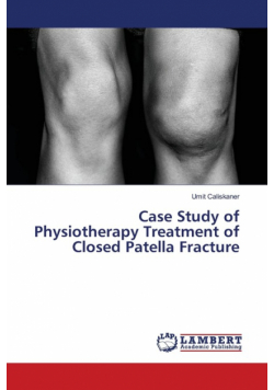 Case Study of Physiotherapy Treatment of Closed Patella Fracture