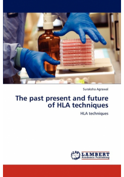 The Past Present and Future of HLA Techniques