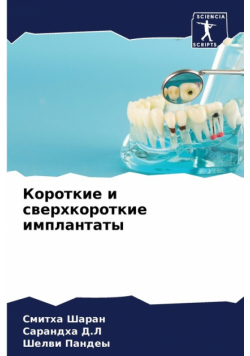Короткие и сверхкороткие имплантаты