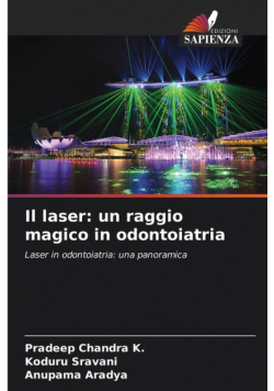Il laser