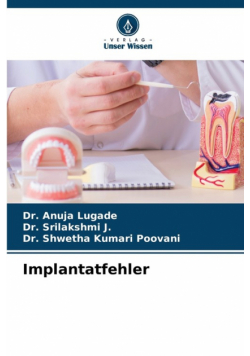 Implantatfehler