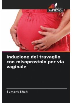 Induzione del travaglio con misoprostolo per via vaginale