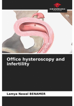 Office hysteroscopy and infertility