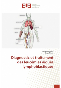 Diagnostic et traitement des leucémies aiguës lymphoblastiques