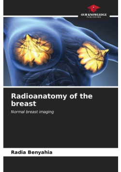 Radioanatomy of the breast