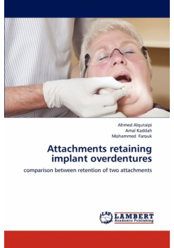 Attachments retaining implant overdentures
