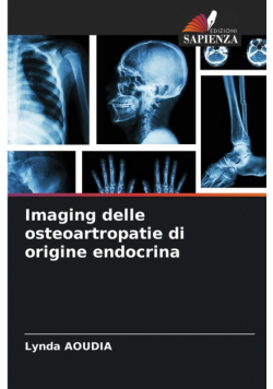 Imaging delle osteoartropatie di origine endocrina