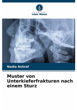 Muster von Unterkieferfrakturen nach einem Sturz