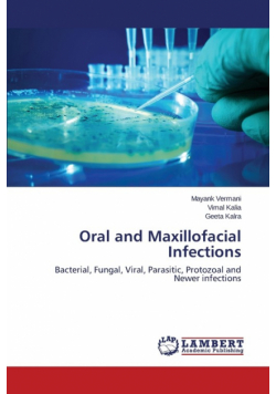 Oral and Maxillofacial Infections