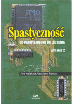Spastyczność