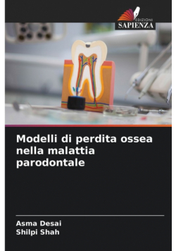 Modelli di perdita ossea nella malattia parodontale