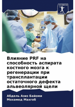 Влияние Prf На Способность Аспирата Костного Мозга К Регенерации При Трансплантации Остаточного Дефекта Альвеолярной Щели