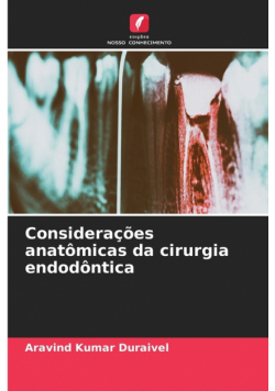 Considerações anatômicas da cirurgia endodôntica