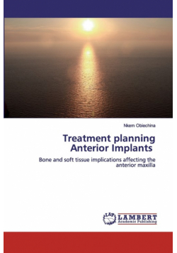 Treatment planning Anterior Implants
