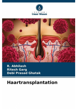 Haartransplantation