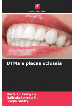 DTMs e placas oclusais