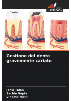 Gestione del dente gravemente cariato