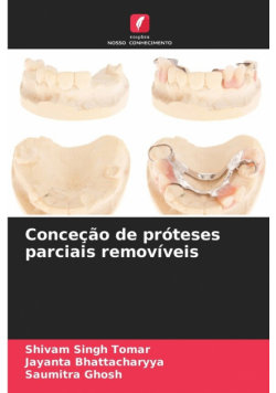 Conceção de próteses parciais removíveis