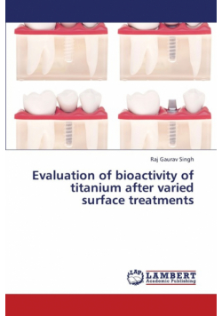 Evaluation of Bioactivity of Titanium After Varied Surface Treatments