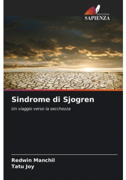 Sindrome di Sjogren