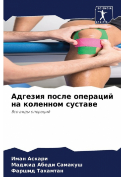 Адгезия после операций на коленном суставе