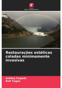 Restaurações estéticas coladas minimamente invasivas