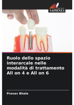 Ruolo dello spazio interarcale nelle modalità di trattamento All on 4 e All on 6