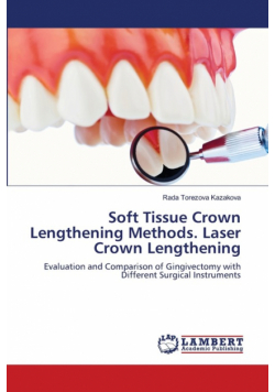 Soft Tissue Crown Lengthening Methods. Laser Crown Lengthening