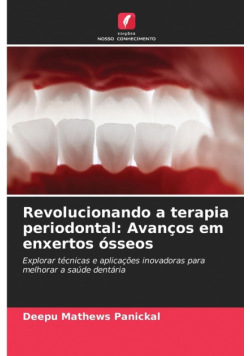 Revolucionando a terapia periodontal