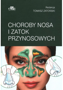 Choroby nosa i zatok przynosowych