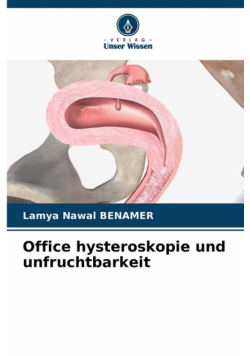 Office hysteroskopie und unfruchtbarkeit