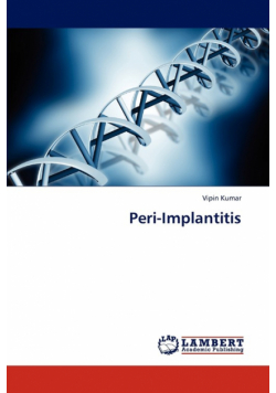 Peri-Implantitis