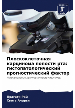 Плоскоклеточная карцинома полости рта