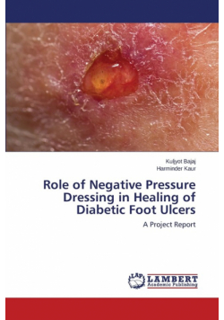 Role of Negative Pressure Dressing in Healing of Diabetic Foot Ulcers