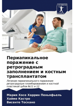 Периапикальное поражение с ретроградным заполнением и костным трансплантатом