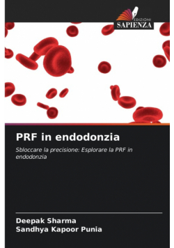 PRF in endodonzia