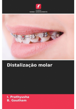 Distalização molar
