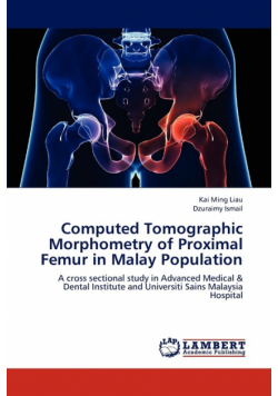 Computed Tomographic Morphometry of Proximal Femur in Malay Population