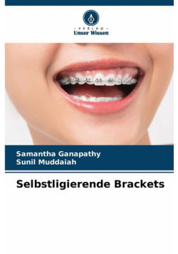 Selbstligierende Brackets