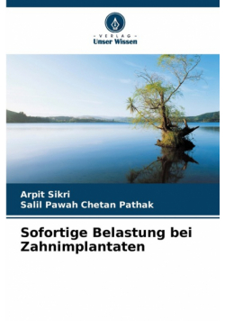 Sofortige Belastung bei Zahnimplantaten