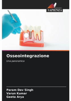 Osseointegrazione
