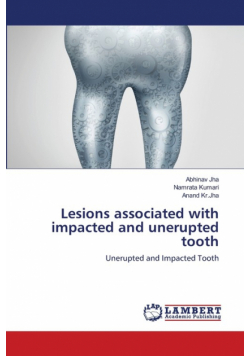 Lesions associated with impacted and unerupted tooth