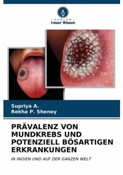Prävalenz Von Mundkrebs Und Potenziell Bösartigen Erkrankungen