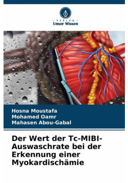 Der Wert der Tc-MIBI-Auswaschrate bei der Erkennung einer Myokardischämie